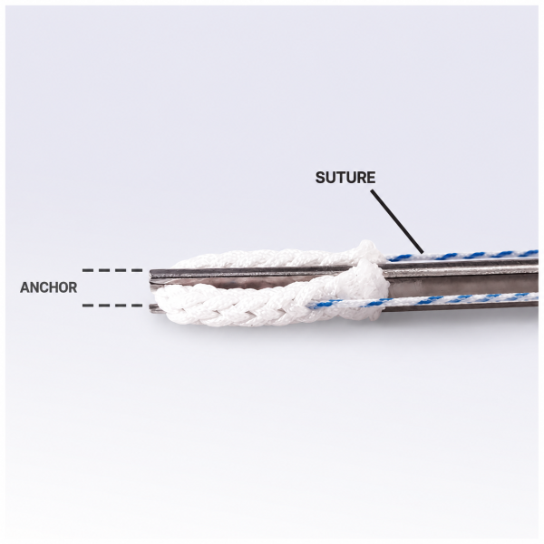 All-Suture Anchor System
